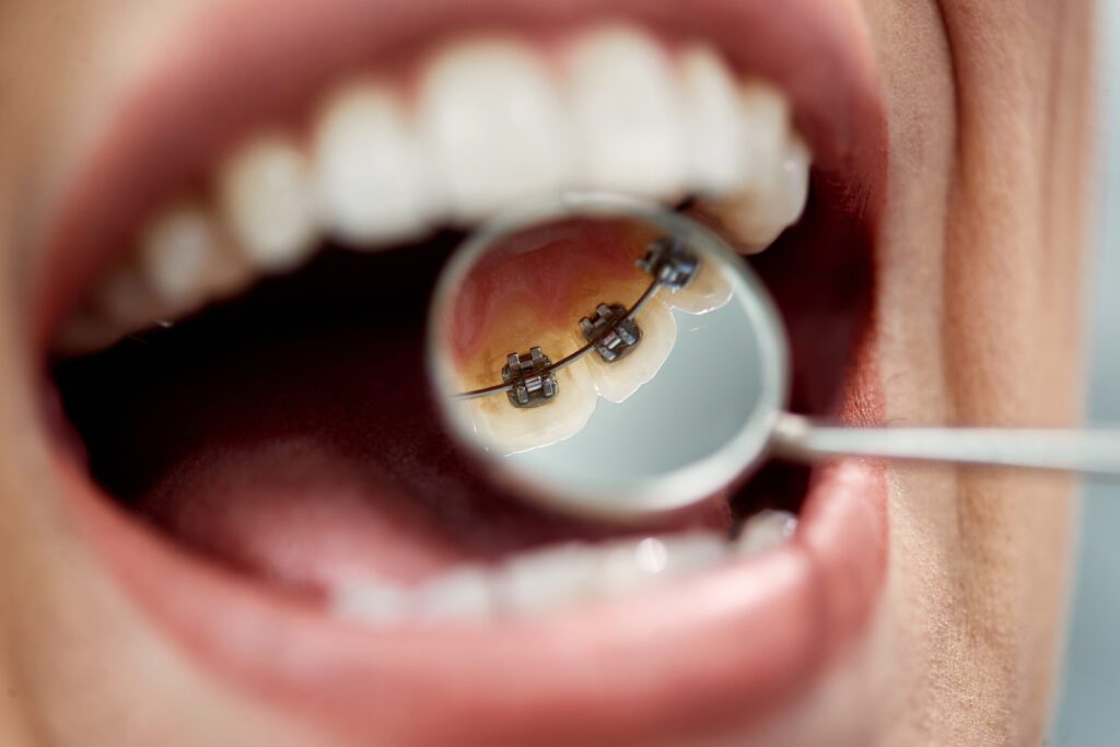 - All Smiles - Dr. Layer DDS, PC
