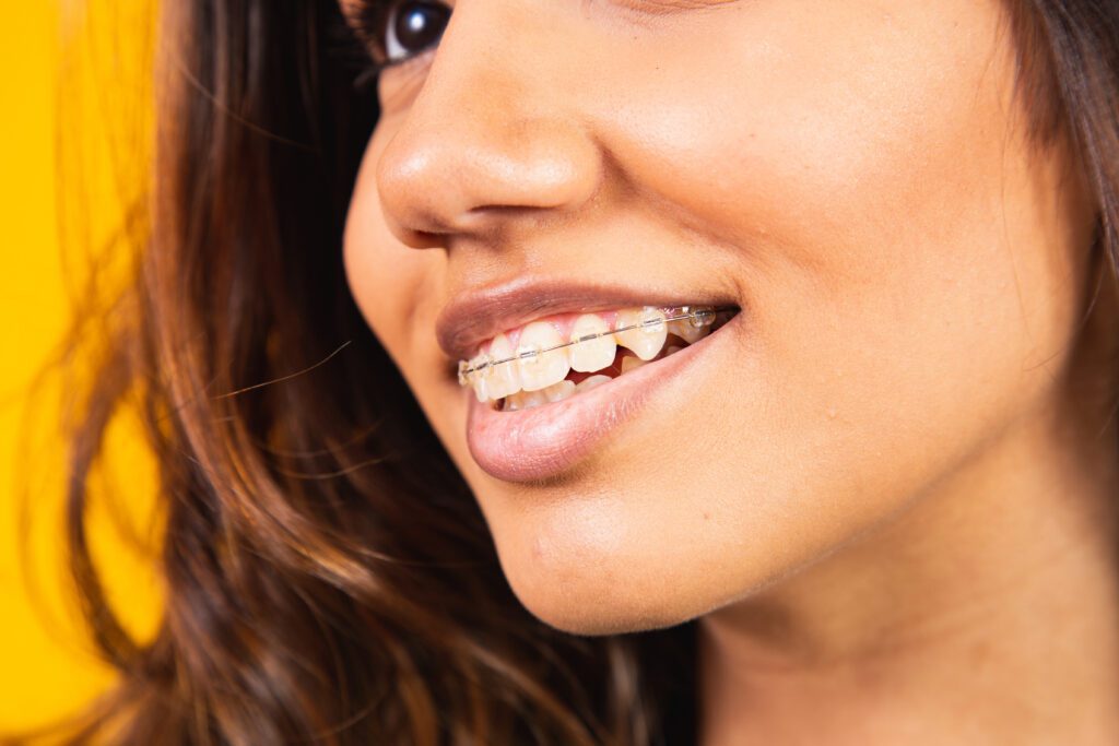 - All Smiles - Dr. Layer DDS, PC