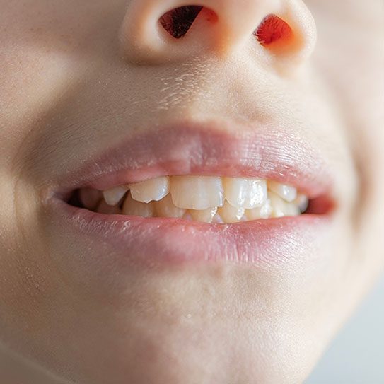 - All Smiles - Dr. Layer DDS, PC